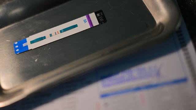 Immunschwäche-Virus: Schätzung: 2.300 neue HIV-Infektionen im Jahr 2024