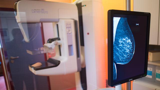 Sachsen: Zwei von fünf Frauen lassen Mammografie-Screening ausfallen