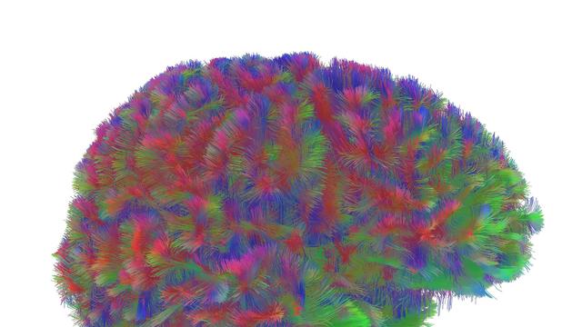 Entwicklung mit Wendepunkten: Kindheit bis Alter – Gehirnstruktur durchläuft fünf Phasen