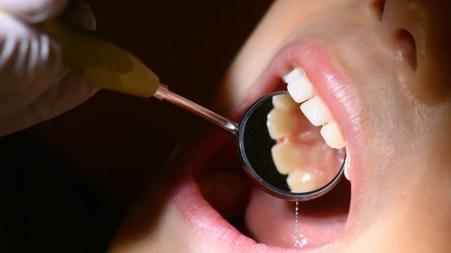 Zahngesundheit: Sachsen will mehr Zahnärzte in die Provinz locken