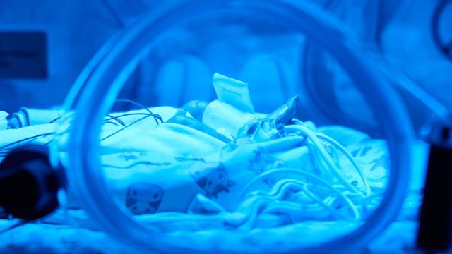 Frühgeborene: Klinikum Suhl behandelt keine sehr kleinen Frühchen mehr