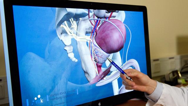 Krebserkrankung: Krankenkasse: Brust- und Prostatakrebs sind am häufigsten