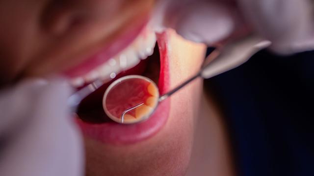 Medizin: Zahl der Zahnarztpraxen in Schleswig-Holstein sinkt