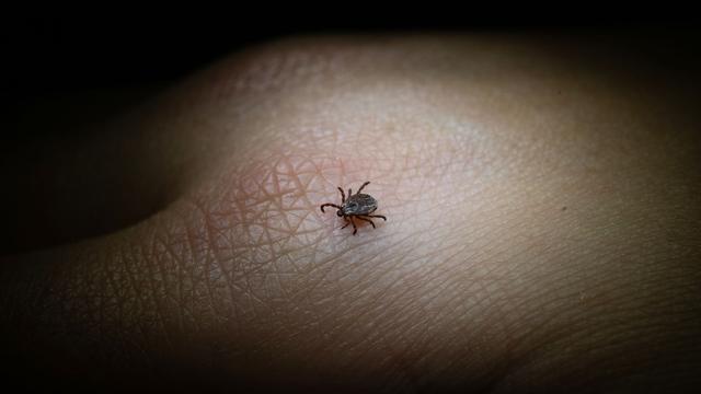 Durch Zecken übertragen: Zwei neue FSME-Risikogebiete in Deutschland ausgewiesen