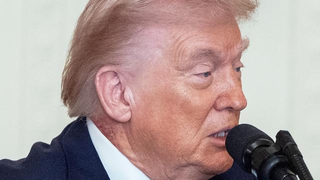 Debatte um Trumps Fitness: Fleck am Hals befeuert Spekulationen über Trumps Gesundheit