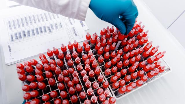 Wissenschaft: Halle baut Kryolager aus – Millionen für Forschung an Proben