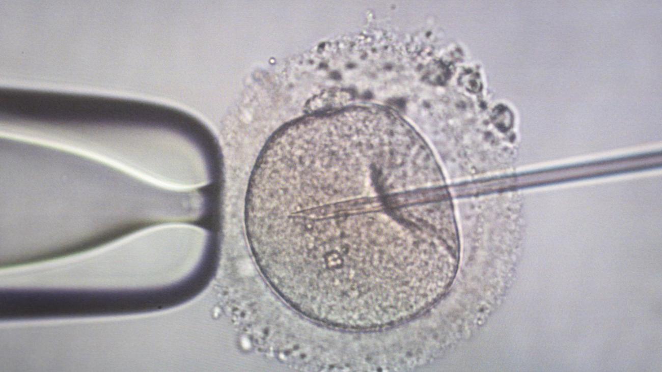 Wunsch nach einem Baby: Kinderwunschpaare: Weniger Geld, weniger Chancen