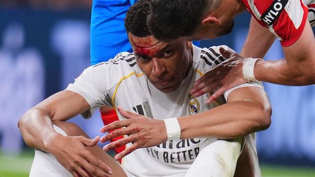 Bild: Champions League: Vor Bayern-Rückspiel: Mbappé fehlt Madrid im Training