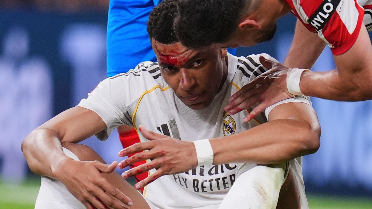 Champions League: Vor Bayern-Rückspiel: Mbappé fehlt Madrid im Training