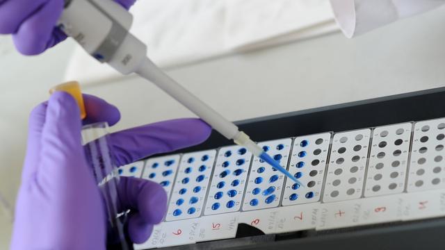 Infektionskrankheiten: Nach Hantavirus auf Schiff: Wie ist die Lage im Südwesten?