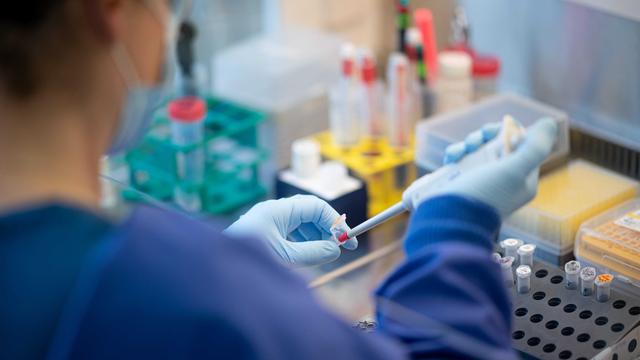 Forschung zu Infektionen: Wie ein neues Zentrum gegen Pandemien helfen soll