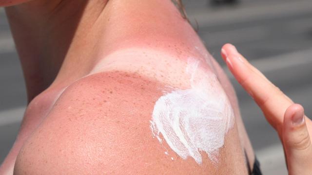 UV-Schutz nötig: Was man bei Kaiserwetter draußen beachten sollte