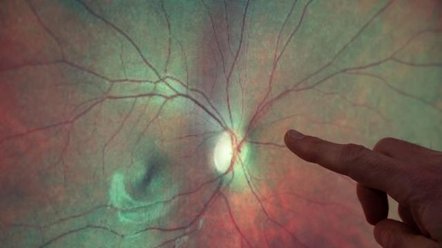 Künstliche Intelligenz: Vernetzung von Gesundheitsdaten für KI-Training gefordert
