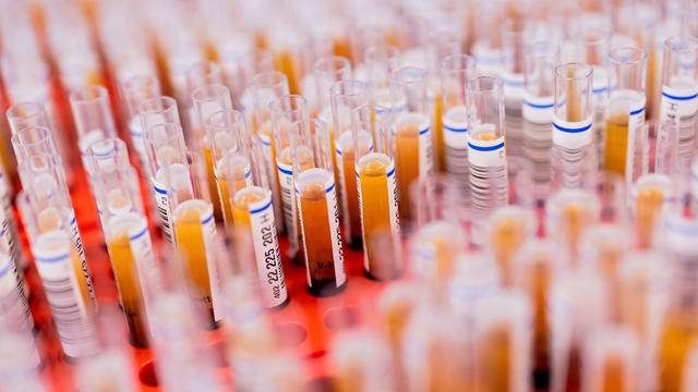 Courier carrying hazardous samples crashes on German highway, driver seriously injured