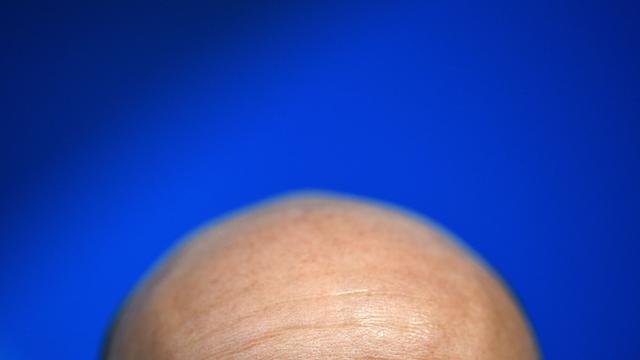 Weltrekordversuch: Die Glatze wird heute in Berlin gleich zweimal gefeiert