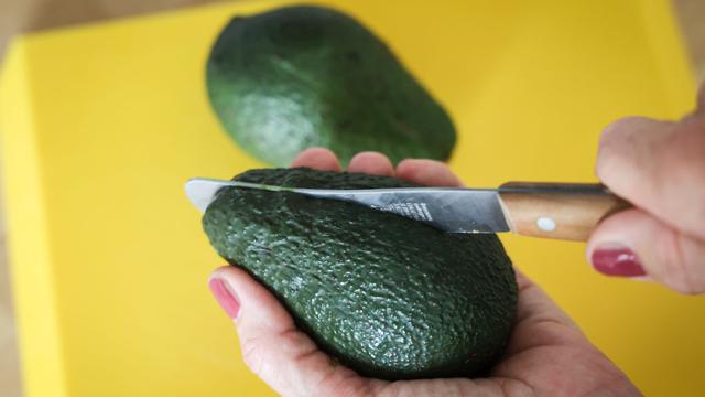 Notaufnahmedaten: «Avocado-Hand»-Fälle steigen – Mehr Frauen betroffen