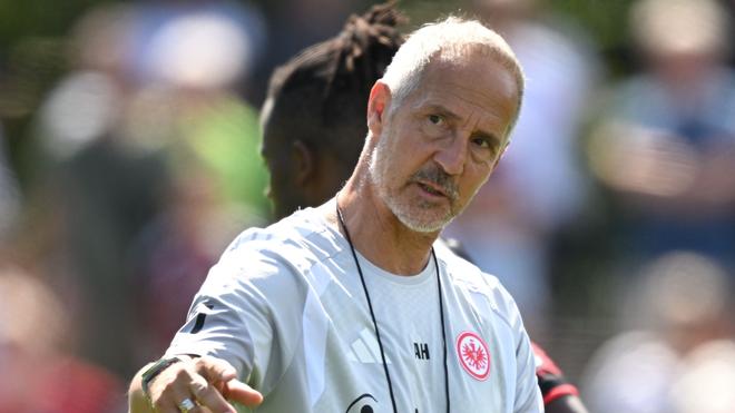Bundesliga: Adi Hütter startet mit einigen Sorgen in die Saison. (Archivbild)