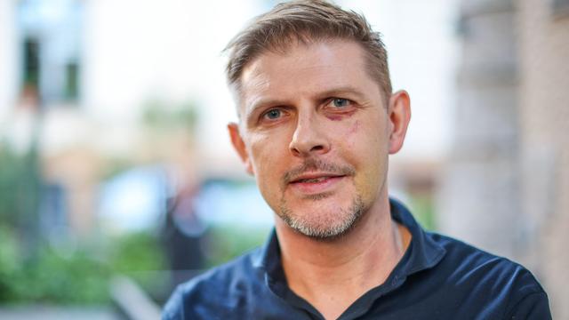 Beim Plakatieren attackiert: Prozess um Angriff auf SPD-Politiker Ecke 2027