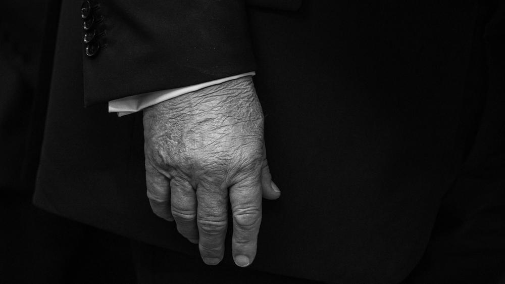  Wie fit ist der US-Präsident? Auch große Blutergüsse an den Händen, die sich immer wieder einmal bei Donald Trump zeigen, befeuern Spekulationen.