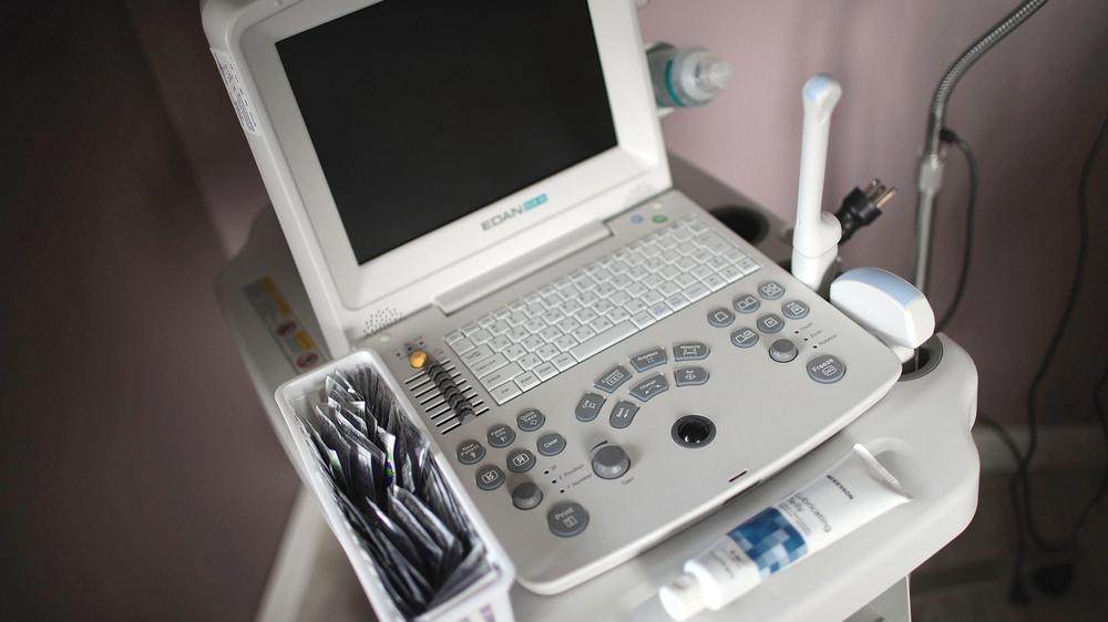 USA: Ein Ultraschallgerät steht in einer Klinik in den USA, in der auch Schwangerschaftsabbrüche vorgenommen werden.