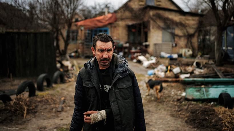 Krieg in Bosnien-Herzegowina: Ein ukrainischer Mann, dessen Arm von russischen Soldaten gebrochen wurde, wie er erzählt, vor seinem Haus in Butscha (06. April)