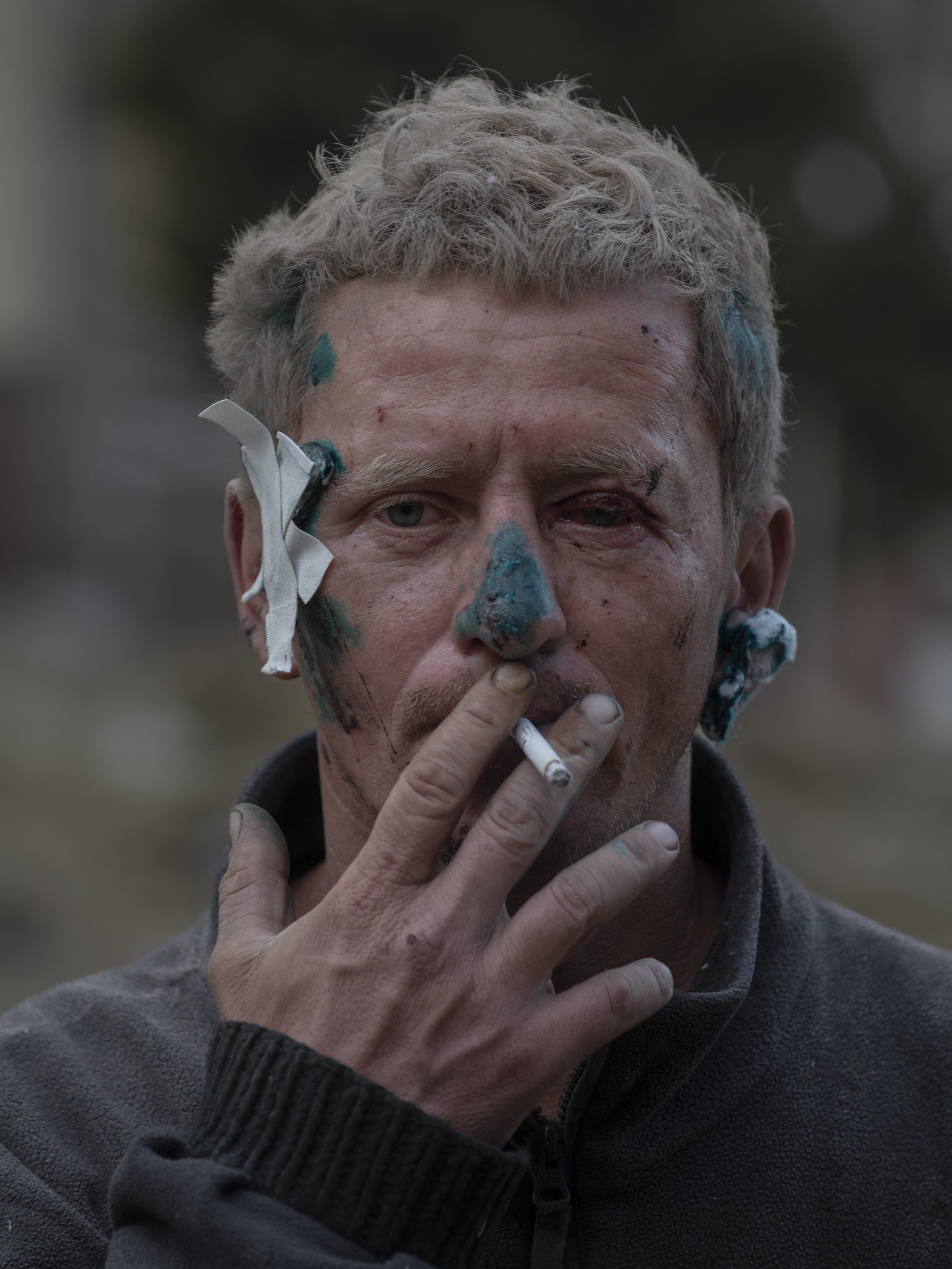 Antoni Lallican: Der 36-jährige Yuri zeigt Verletzungen im Gesicht, die er bei einem Angriff auf sein Wohnhaus in Kostiantynivka erlitten hat, weigert sich jedoch trotz der anhaltenden russischen Drohnenangriffe und seiner Mittellosigkeit, die Stadt zu verlassen. Kostiantynivka, eine strategisch wichtige Stadt im Donbass, liegt nur zehn Kilometer von russischen Stellungen entfernt und hat ihre Bevölkerung seit der Invasion 2022 von 68.800 auf etwa 6.000 Mitte September 2025 reduziert.