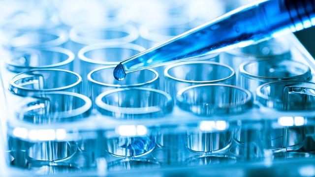 Coronavirus in Deutschland: Stephan Weil erwartet PCR-Test-Priorisierung erst "in einigen Wochen"