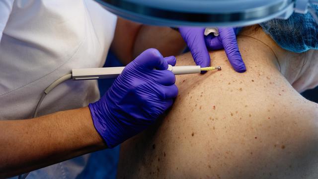 GKV-Reform: Was sich durch die Reform der Krankenversicherung für Patienten ändert