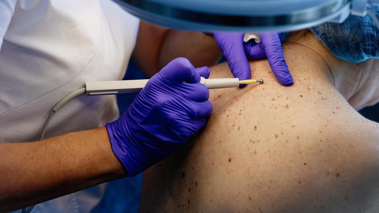 GKV-Reform: Was sich durch die Reform der Krankenversicherung für Patienten ändert