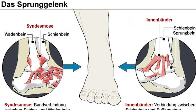 Sportmedizin: Ballacks Verletzung verheilt nur langsam | ZEIT ONLINE
