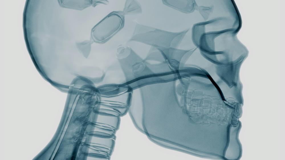 Cheating packages: If you think about sweets too often, higher prices could help you