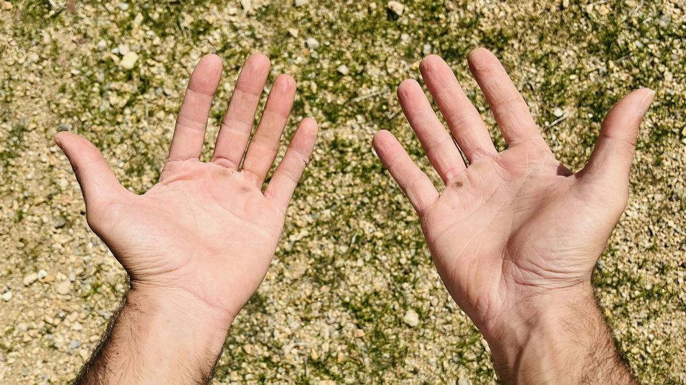 The dream of a lush, green lawn: editors at ZEIT failed. Can you help us?