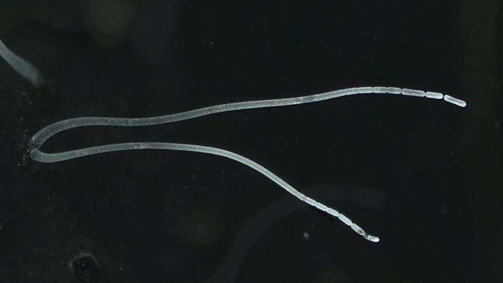 "Thiomargarita magnifica": Forschende entdecken weltweit größtes ...