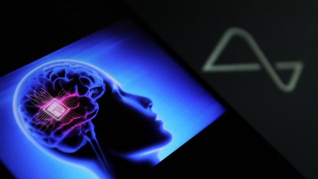 Gehirnimplantat: Patient mit Neuralink-Chip spielt Schach mit seinen Gedanken