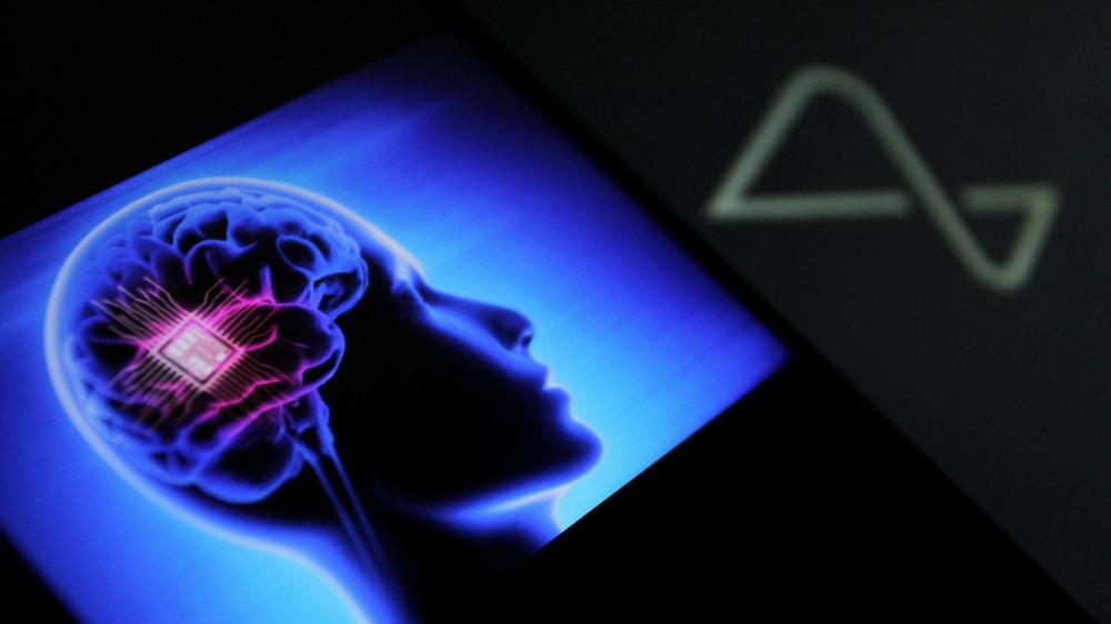 Gehirnimplantat: Patient mit Neuralink-Chip spielt Schach mit seinen  Gedanken | DIE ZEIT