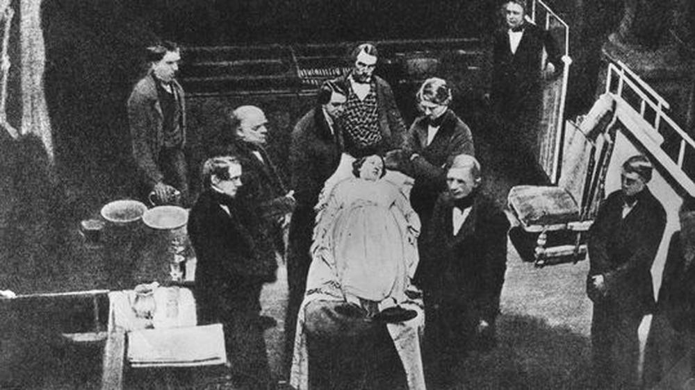 Mediziner stellen 1846 die erste Operation nach, in der Äther als Narkosemittel eingesetzt worden ist. Die Aufnahme entstand in einem Bostoner OP-Saal mit dem Fotografie-Verfahren der Daguerreotypie.