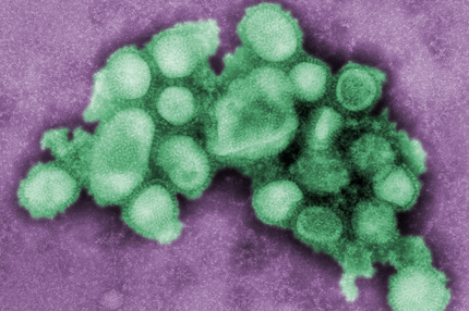Schweinegrippe Virus H1N1