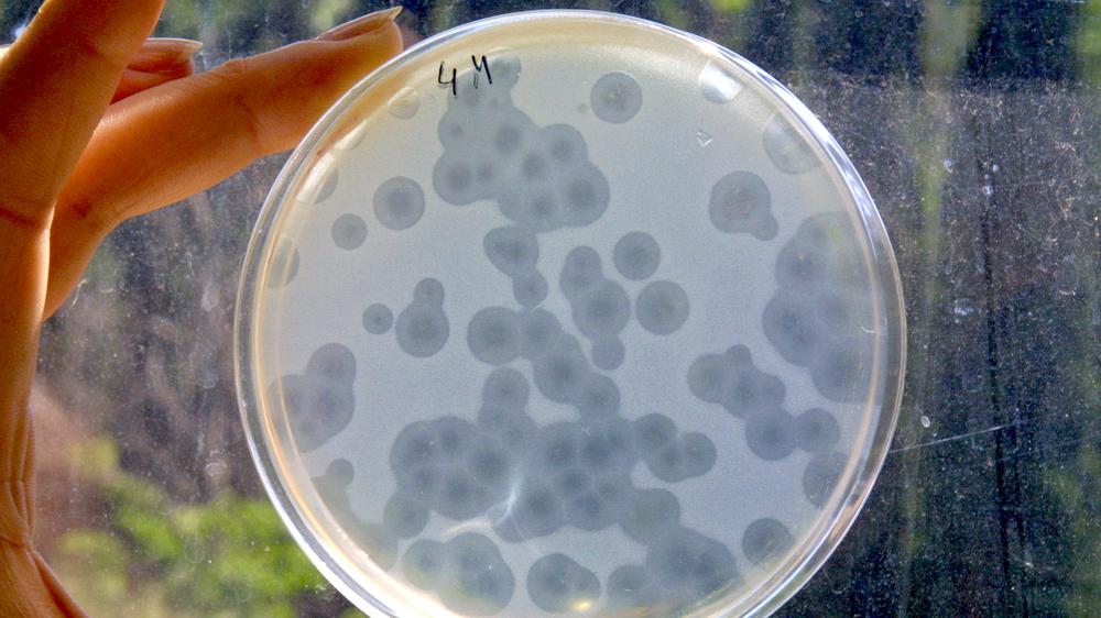 Krankenhauskeime: Eine Ärztin hält eine Petrischale mit Staphylokokken.