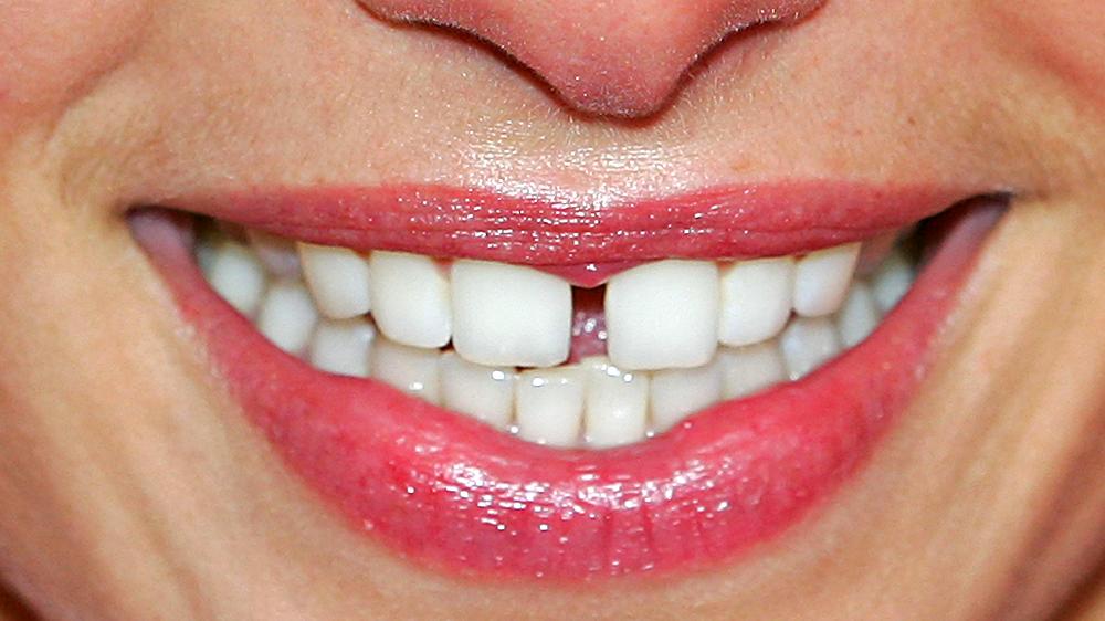 Zahnpflege Reinigung Zahnpasta Zähne Lächeln Mundhygiene