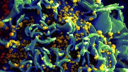 Aids Und Hiv Die Generation 50 Vergisst Das Kondom Zeit Online