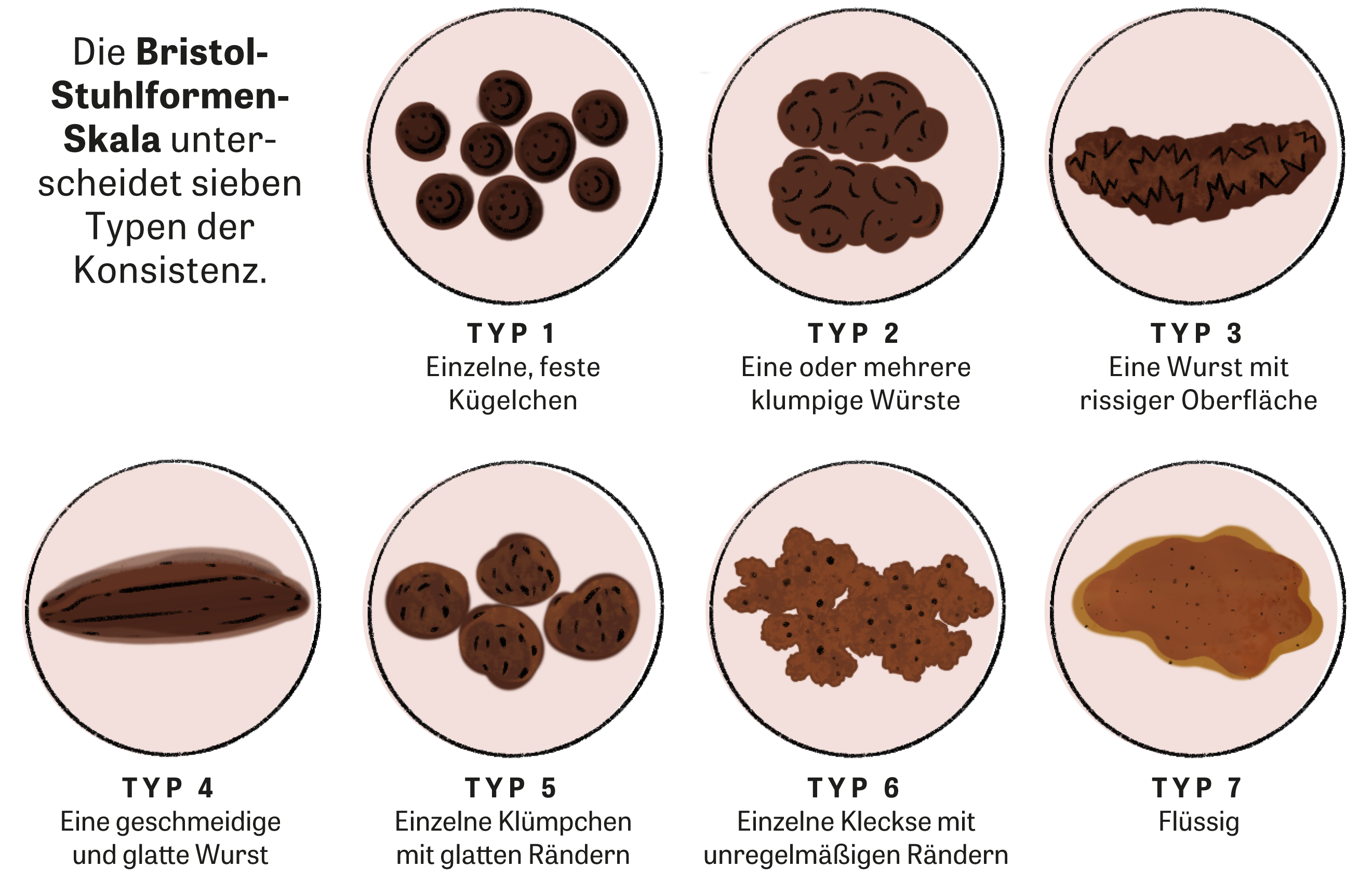 Liebhaber Feind Oberer Höher Voluminöser Stuhl Ursachen Kokain