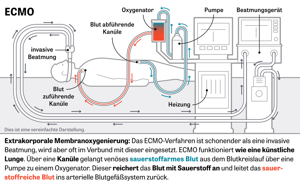 pflanztopf in kopfform  Pflanzgef Kopf