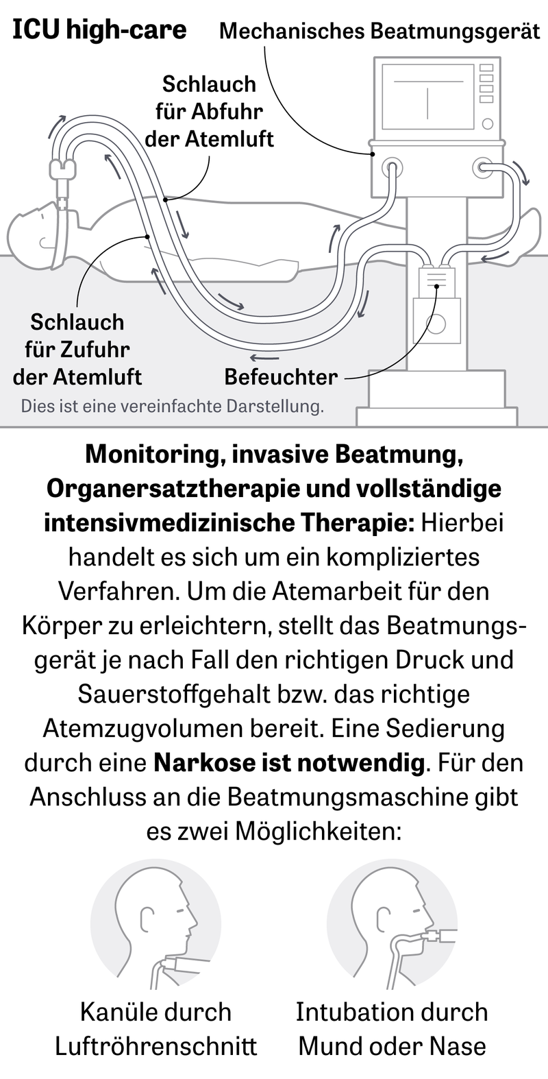 Beatmungstherapie: Besteht ein Infektionsrisiko fr Krankenhauspersonal? |  DIE ZEIT