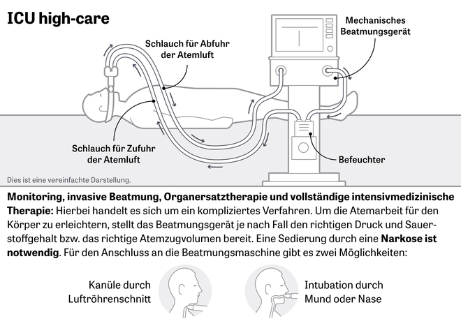 Beatmungstherapie: Monitoring, invasive Beatmung, Organersatztherapie und vollständige intensivmedizinische Therapie