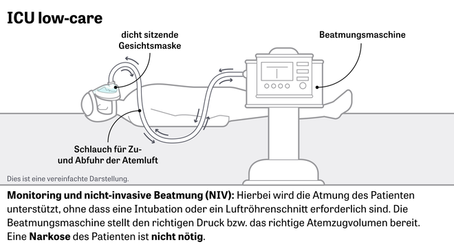 Beatmungstherapie: Monitoring und nicht-invasive Beatmung