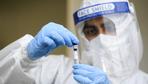 Coronavirus: Zahl der Neuinfektionen im Wochenvergleich annähernd stabil