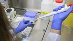 Coronavirus: Gesundheitsämter melden 18.030 Neuinfektionen