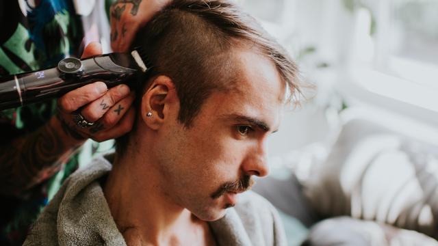 Haarverlust bei Männern: Wie gehen Sie mit Haarausfall um?