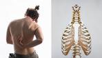 Rückenschmerzen: Der Rücken
