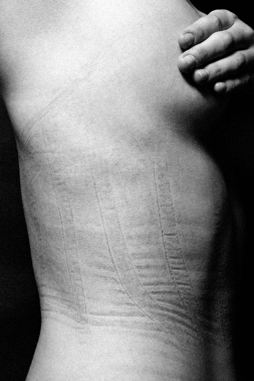 Abdrcke auf der Haut: Abdrcke auf der Haut: Diese Fotos hinterfragen  Schnheitsideale | DIE ZEIT